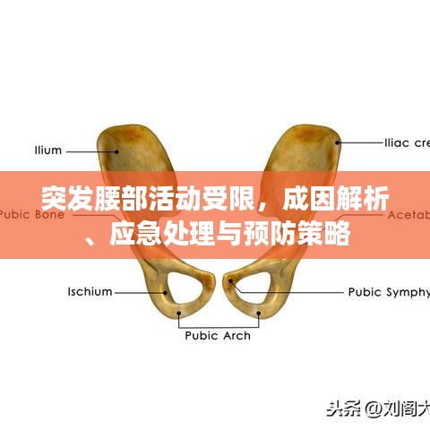 突發(fā)腰部活動(dòng)受限，成因解析、應(yīng)急處理與預(yù)防策略